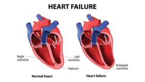 WORLD HEART DAY