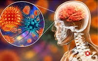 Chandipura virus